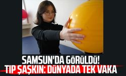 Samsun'da görüldü! Tıp camiası şaşkın: Dünyada tek vaka