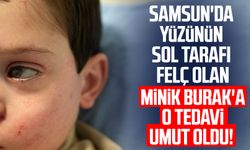 Samsun'da yüzünün sol tarafı felç olan minik Burak Akyasan'a o tedavi umut oldu!