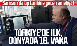 Samsun’da tıp tarihine geçen ameliyat: Türkiye’de ilk, dünyada 18. vaka