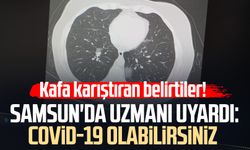 Kafa karıştıran belirtiler! Samsun'da uzmanı uyardı: Covid-19 olabilirsiniz