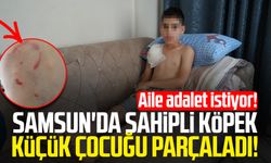 Samsun'da sahipli köpek Yunus Aksoy'u parçaladı: Aile adalet istiyor!