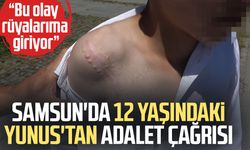 Samsun'da vücudu köpek tarafından parçalanan Yunus'un ilk duruşması görüldü