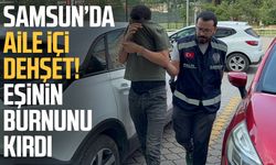Samsun'da eşinin burnunu kırdığı iddia edilen koca tutuklandı