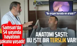 Tüm organları ters yerde: Doktorlar bile şaşırdı