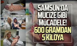Samsun’da mucize gibi mücadele! 600 gramdan 5 kiloya