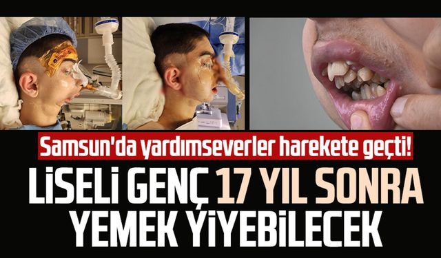 Samsun'da yardımseverler harekete geçti! Yaşar Hüseyin Köksalan, tam 17 yıl sonra yemek yiyebilecek