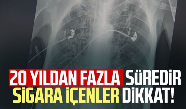 20 yıldan fazladır sigara içenler dikkat! Samsun'da uzman isim uyardı