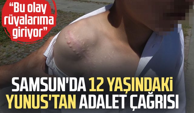 Samsun'da vücudu köpek tarafından parçalanan Yunus'un ilk duruşması görüldü