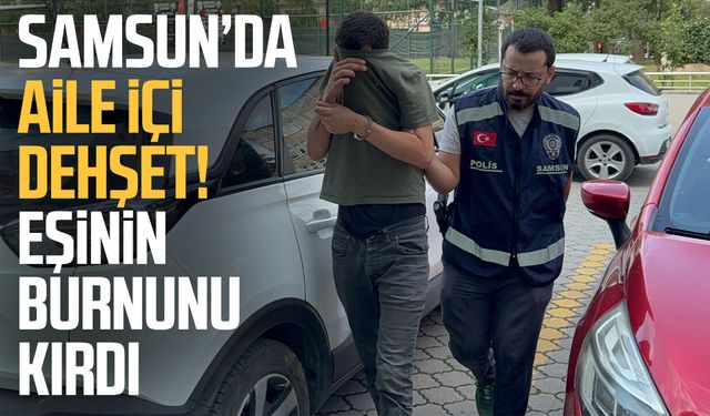Samsun'da eşinin burnunu kırdığı iddia edilen koca tutuklandı