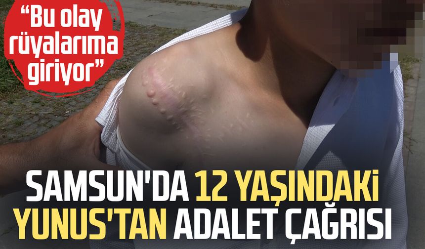Samsun'da vücudu köpek tarafından parçalanan Yunus'un ilk duruşması görüldü