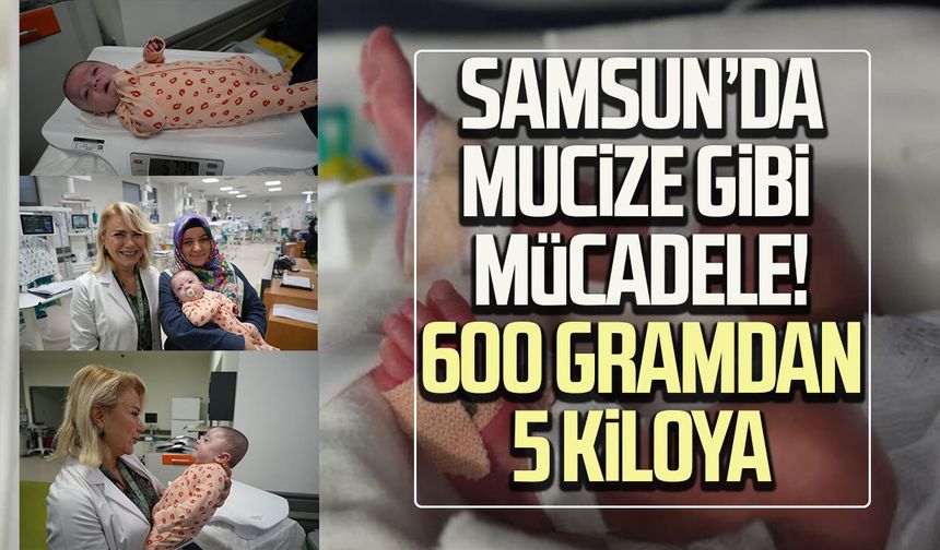 Samsun’da mucize gibi mücadele! 600 gramdan 5 kiloya